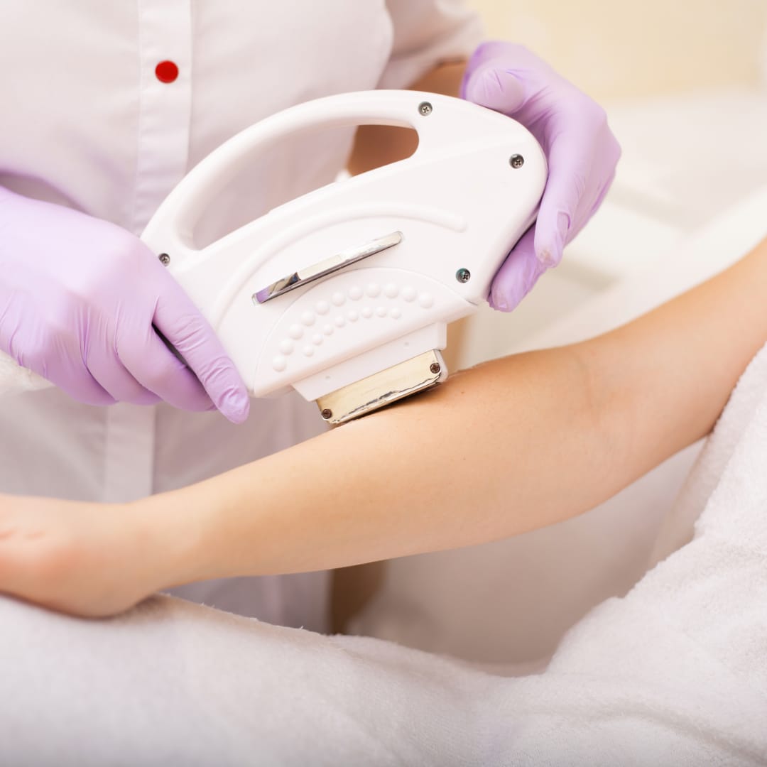 Laser skin procedure