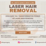 laser hair removal